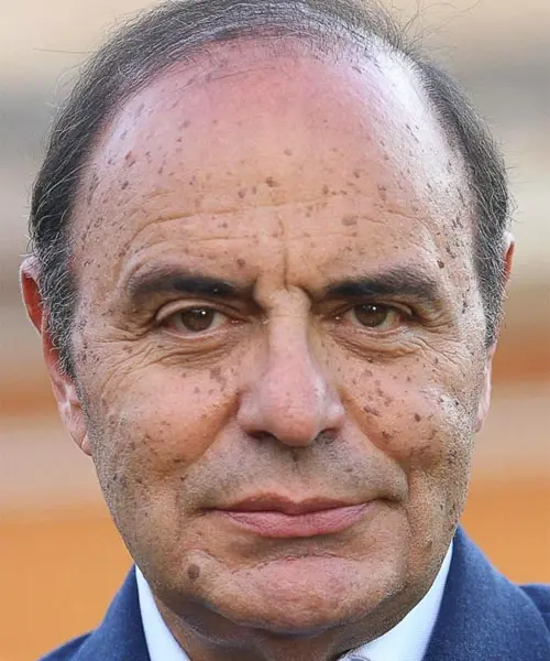 Vondaskel AI investimento